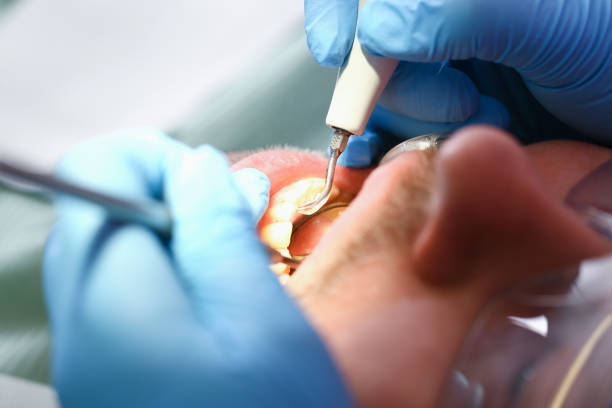 Best Emergency Treatment for Toothache in Raymond, WI