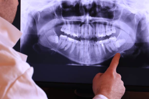 Best Emergency Treatment for Toothache in Raymond, WI